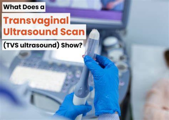 How is TVS ultrasound done?